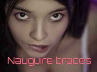 Nauguire_braces